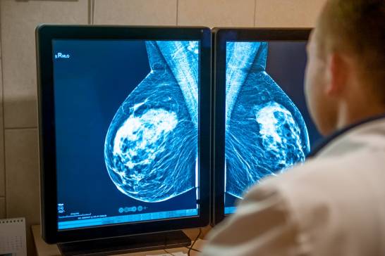 Precizie mai mare în chirurgia conservatoare a cancerului de sân
 – Știință Știri