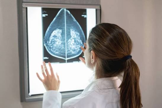 Noua terapie pentru pacientii cu cancer de san metastatic
 – Știință Știri