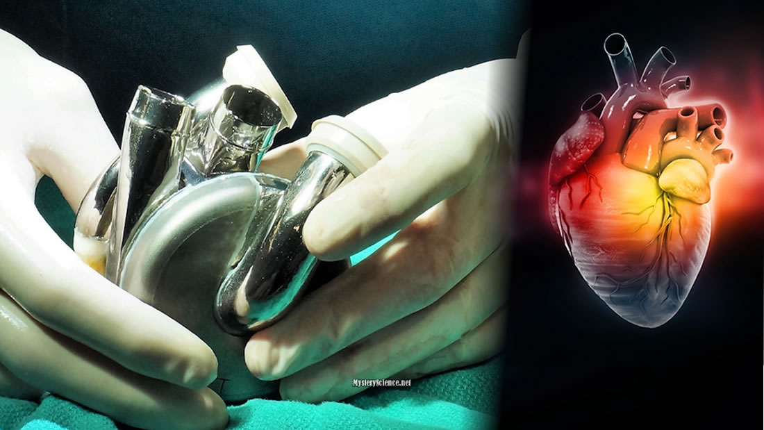 The man lives with a titanium heart for more than 100 days before receiving a transplant – Myty Science